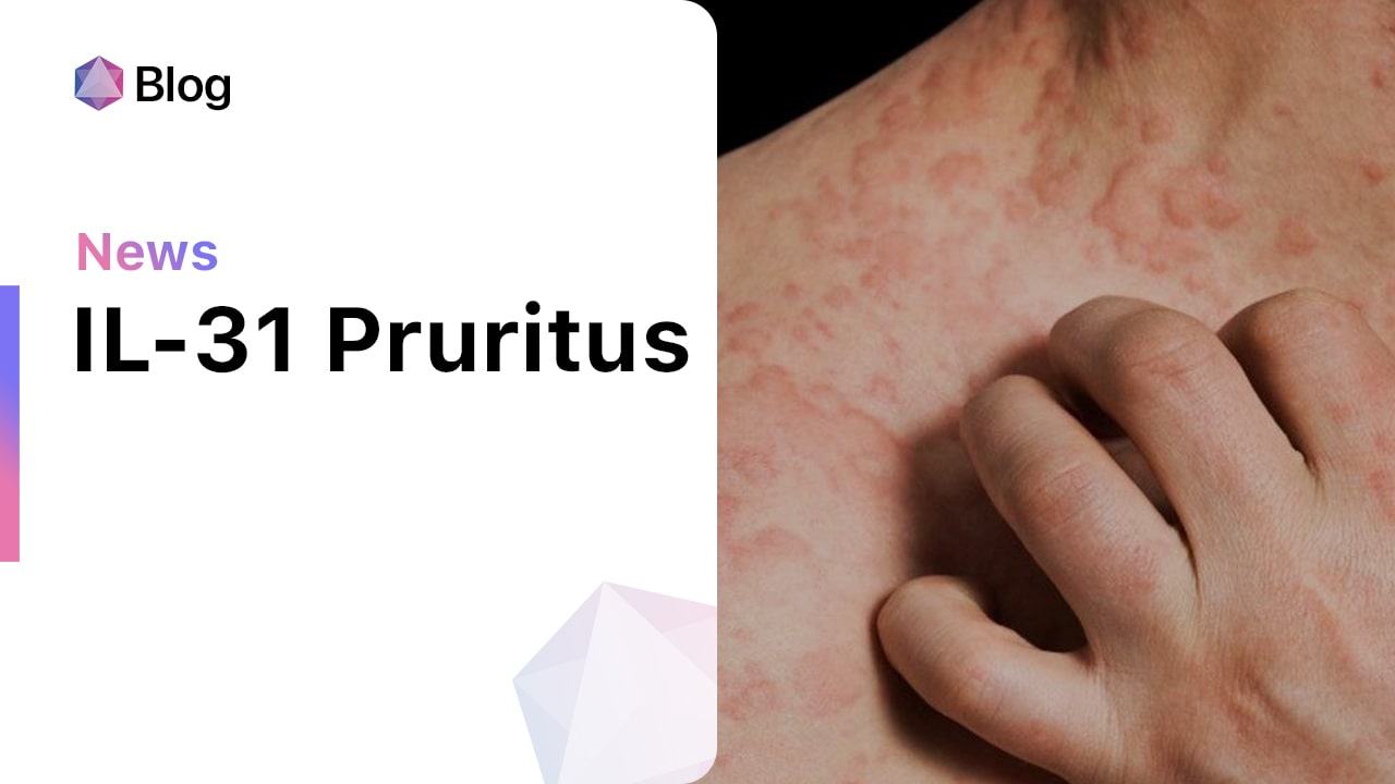 The Role Of Interleukin 31 In Pruritic Skin Diseases 