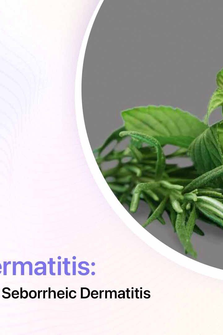 Oregano Oil for Treating Seborrheic Dermatitis