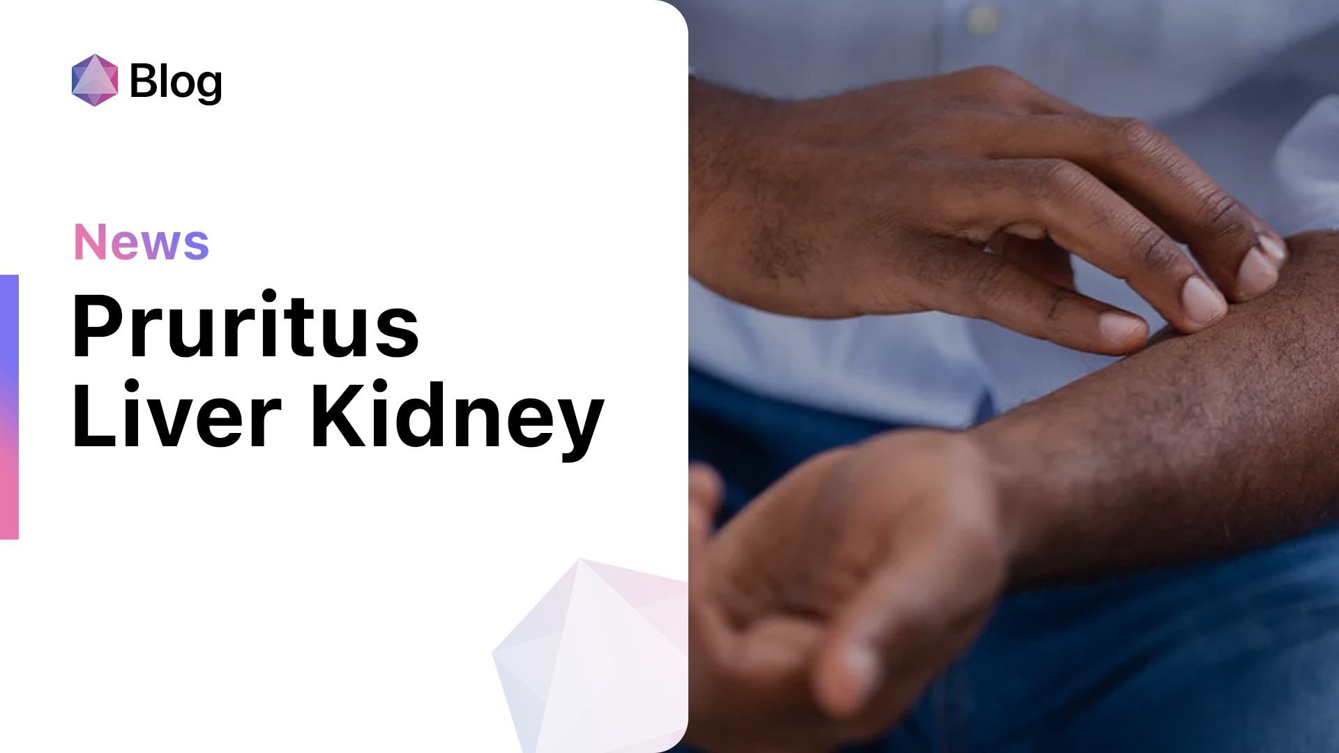 Pruritus In Chronic Kidney Disease