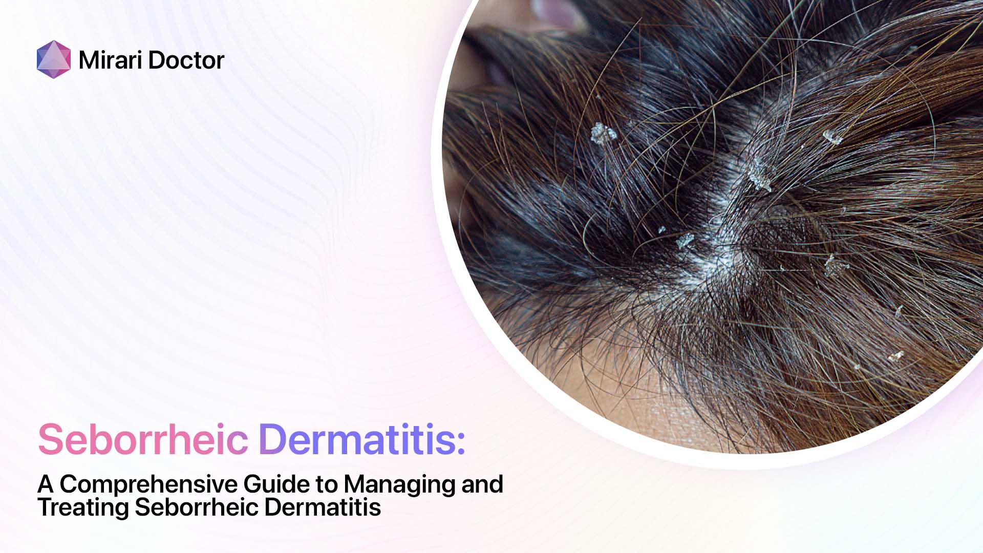 A Comprehensive Guide To Managing And Treating Seborrheic Dermatitis