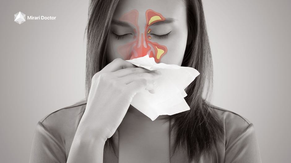 does-acute-sinusitis-go-away