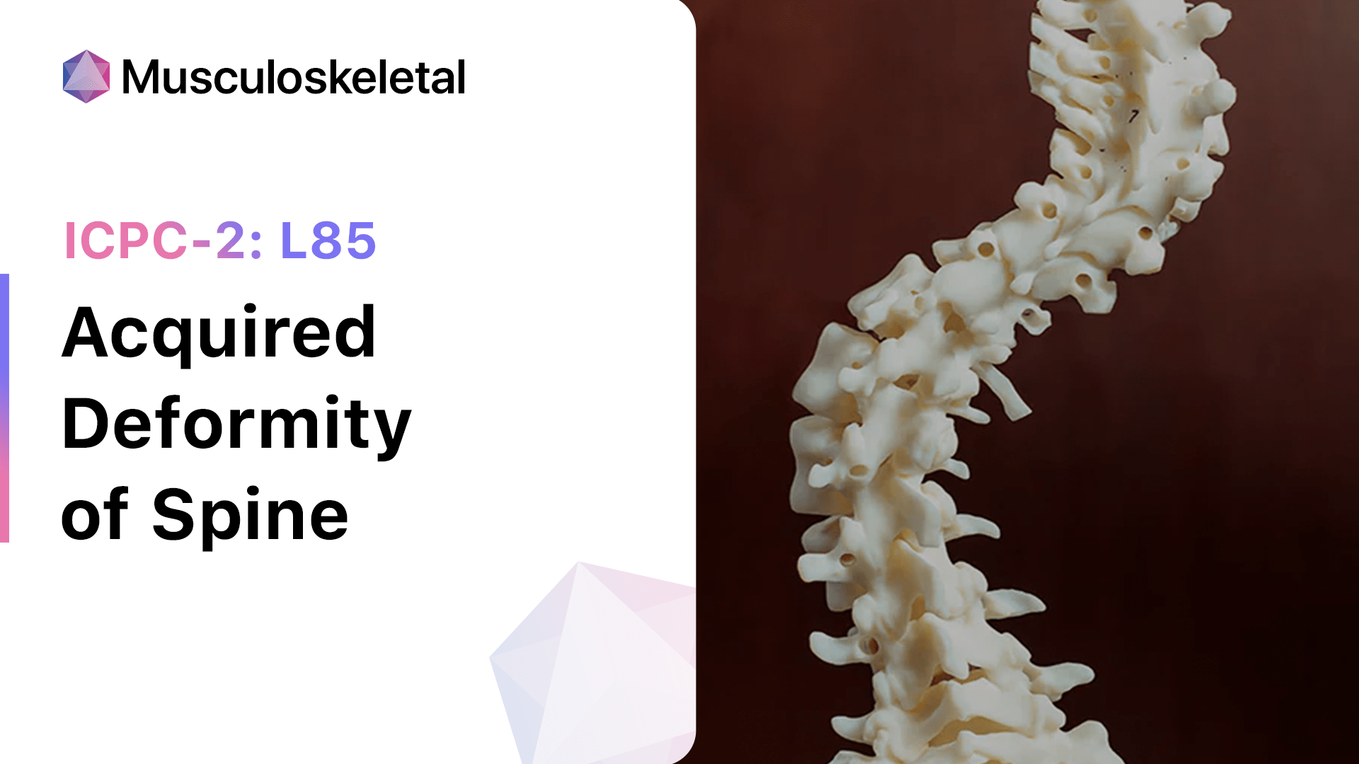 Acquired Deformity of Spine (ICPC-2: L85)