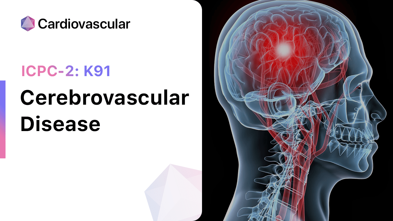 cerebrovascular-disease-icpc-2-k91