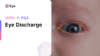 F03 Eye discharge (ICD-10:H57.8)