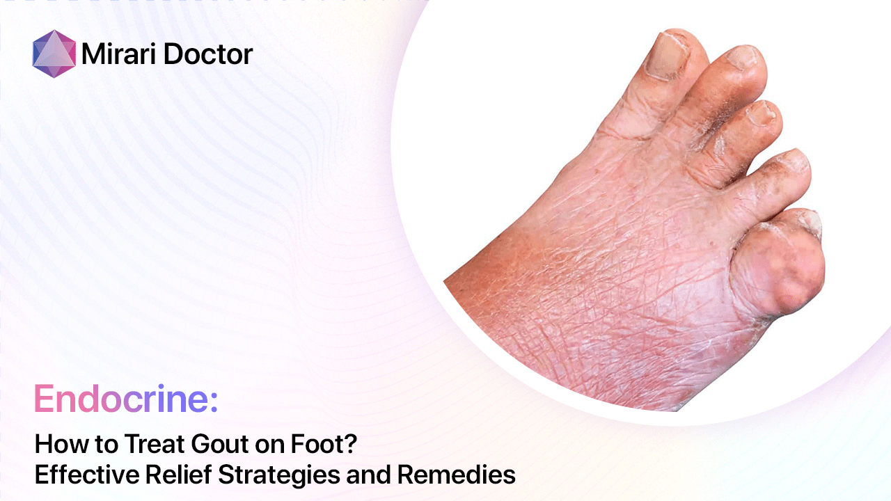 How To Treat Gout On Foot Effective Relief Strategies And Remedies