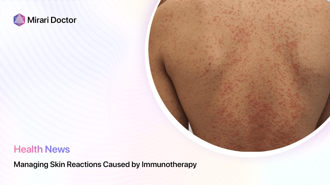 Featured image for “Managing Skin Reactions Caused by Immunotherapy”
