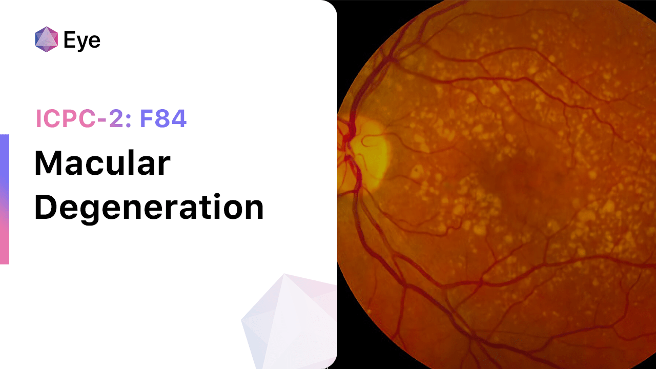 Macular Degeneration (ICPC2 F84)