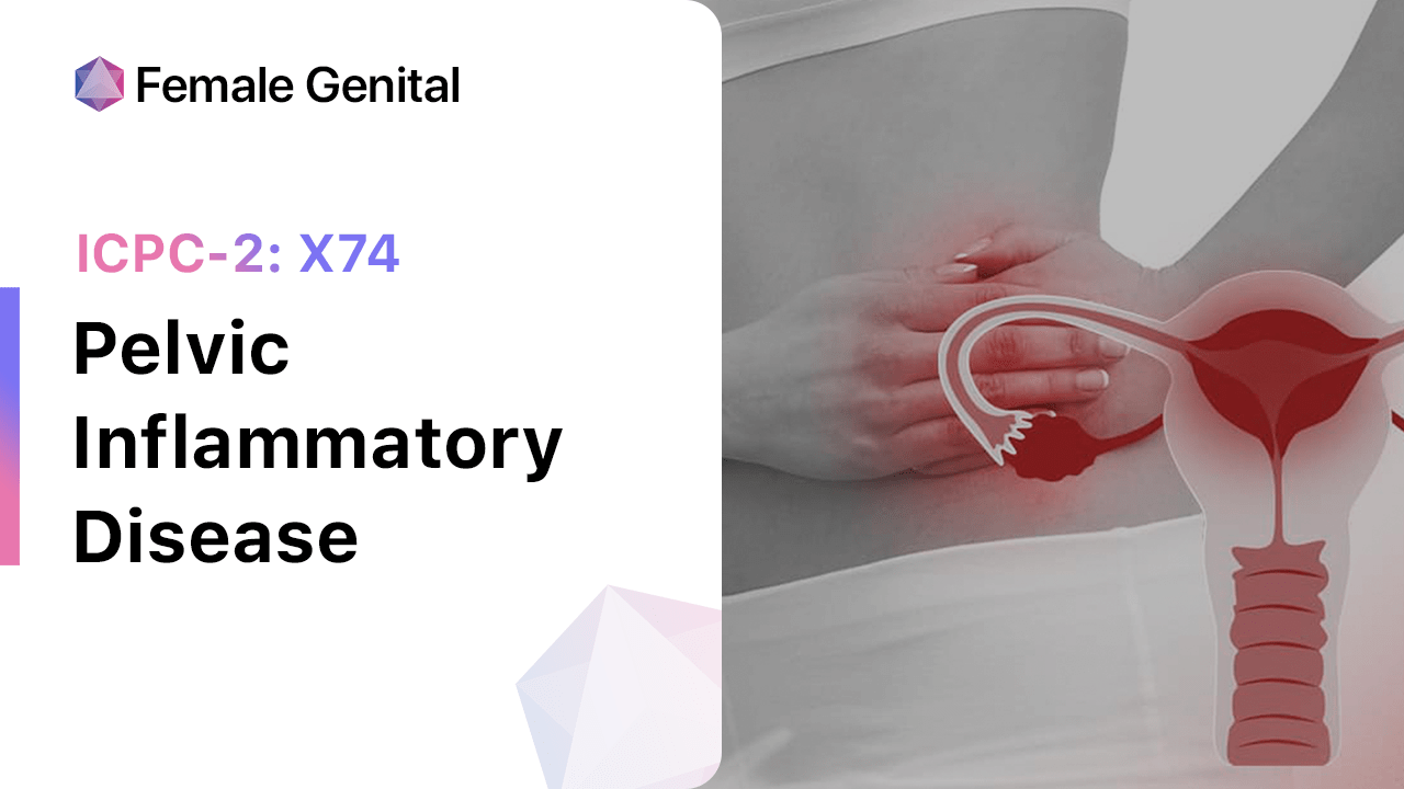 Pelvic Inflammatory Disease (ICPC2 X74)