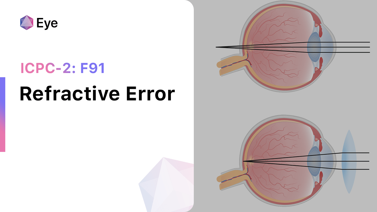 Refractive Error (ICPC-2: F91)