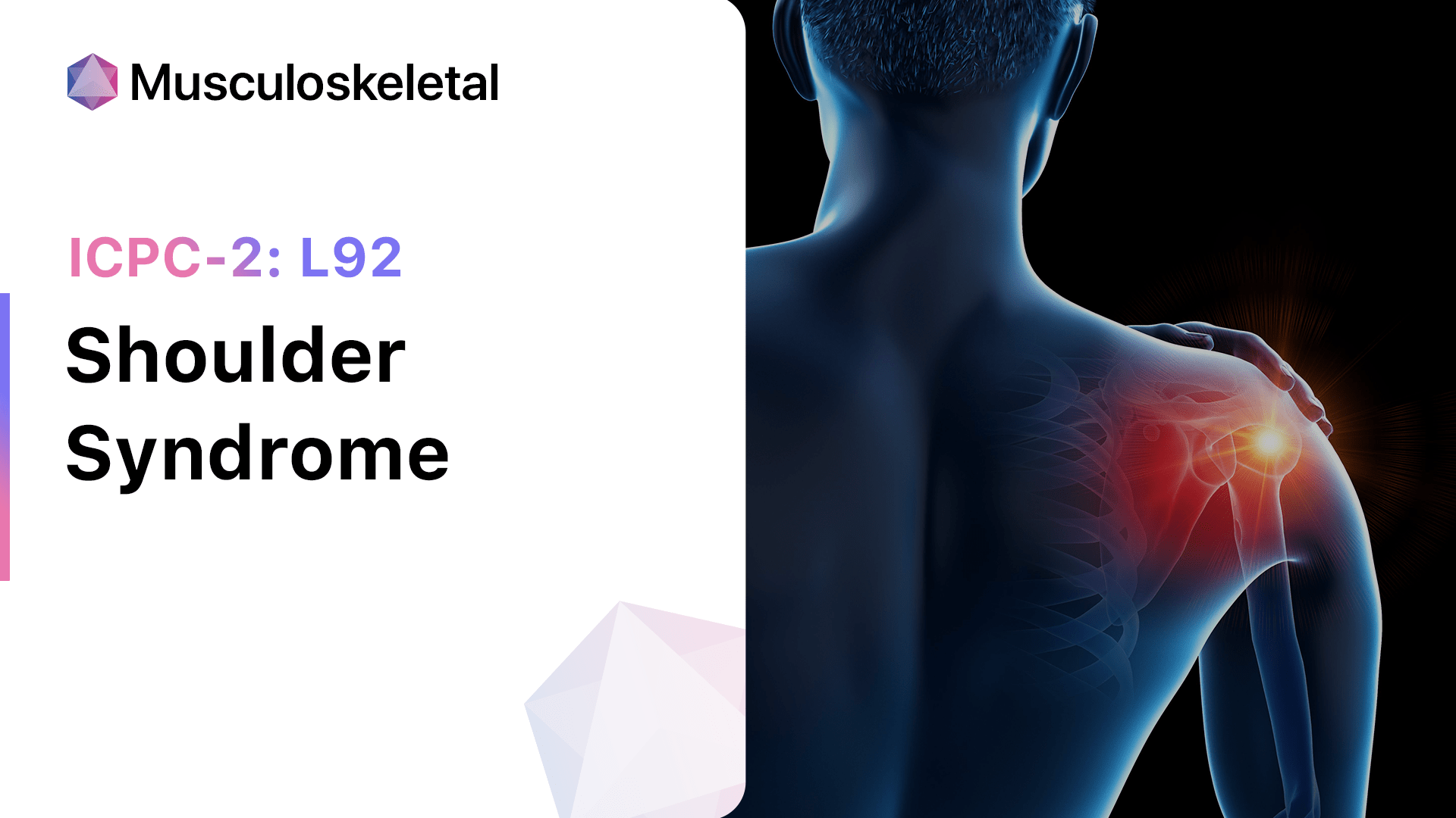 shoulder-syndrome-icpc-2-l92