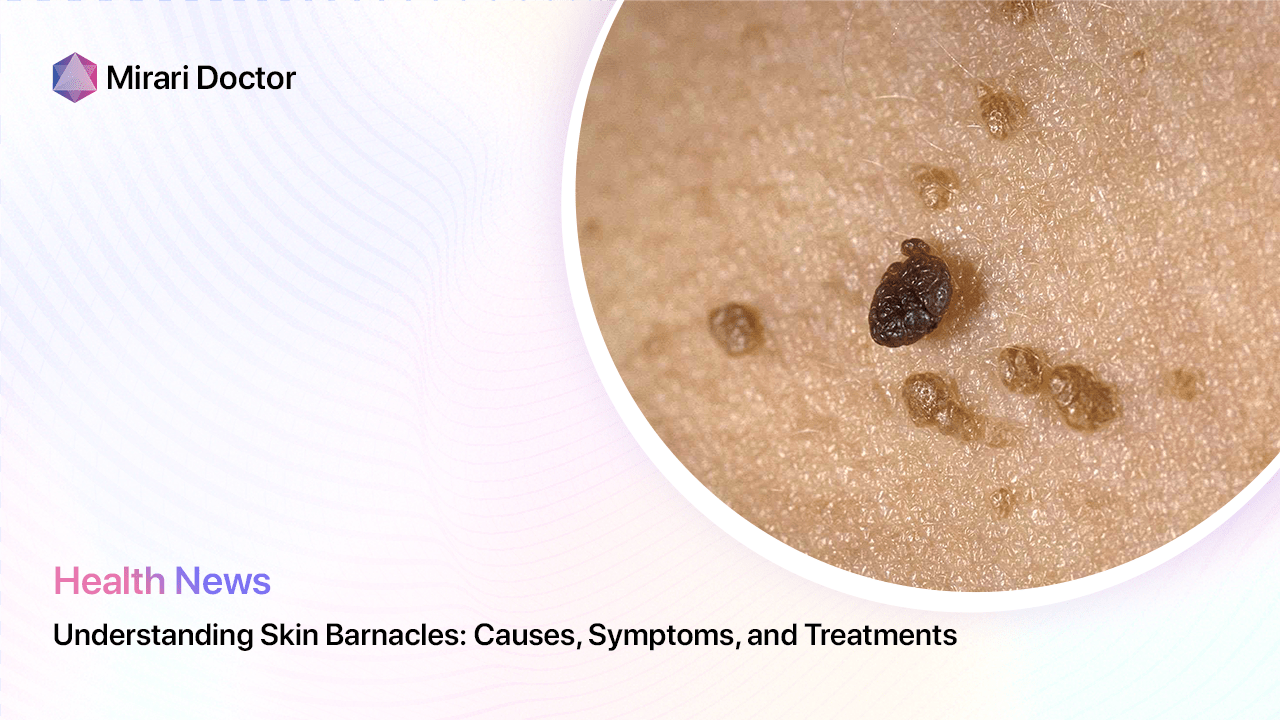 Featured image for “Understanding Skin Barnacles: Causes, Symptoms, and Treatments”