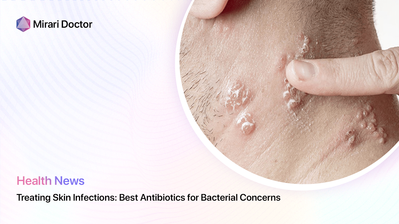 Featured image for “Treating Skin Infections: Best Antibiotics for Bacterial Concerns”