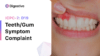 D19 Teeth/gum symptom/complaint (ICD-10:K08.9)
