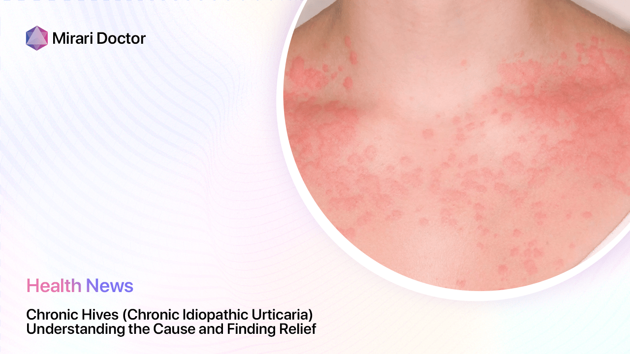 Chronic Hives Chronic Idiopathic Urticaria Understanding The Cause