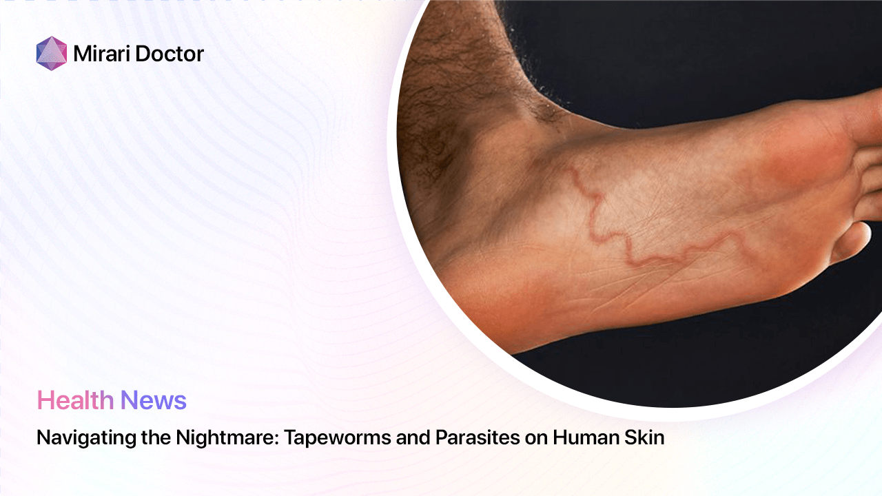 Featured image for “Navigating the Nightmare: Tapeworms and Parasites on Human Skin”