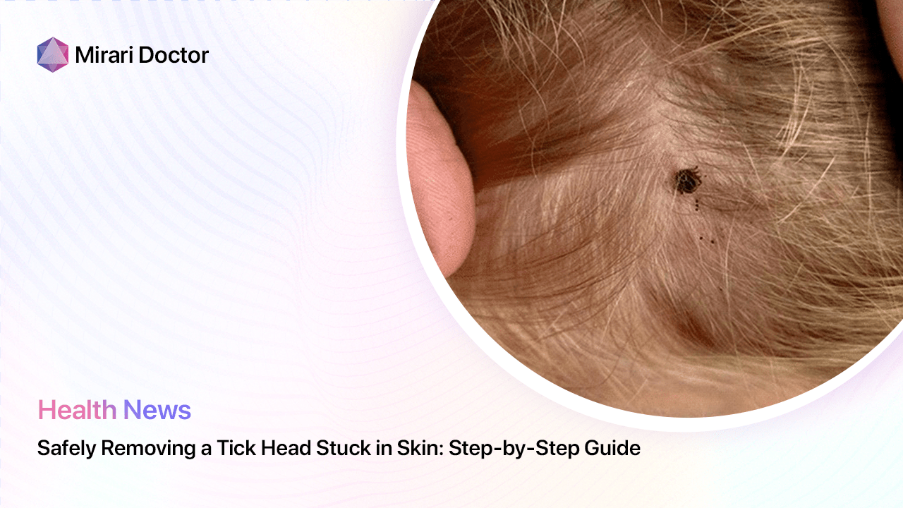 Featured image for “Safely Removing a Tick Head Stuck in Skin: Step-by-Step Guide”