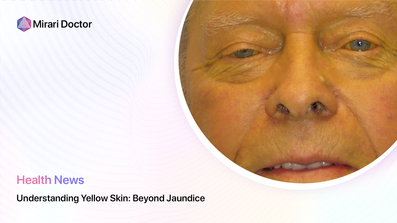Featured image for “Understanding Yellow Skin: Beyond Jaundice”