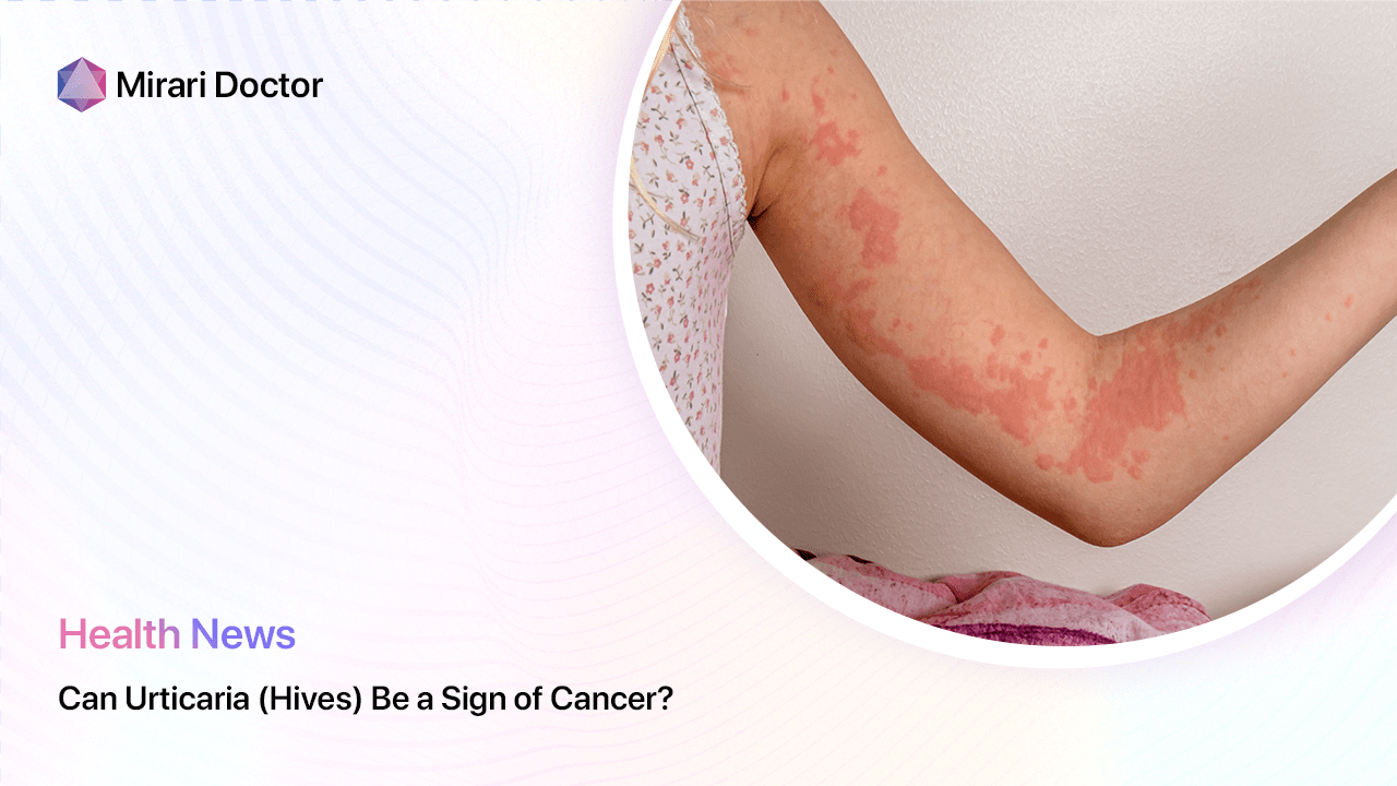 Featured image for “Can Urticaria (Hives) Be a Sign of Cancer?”