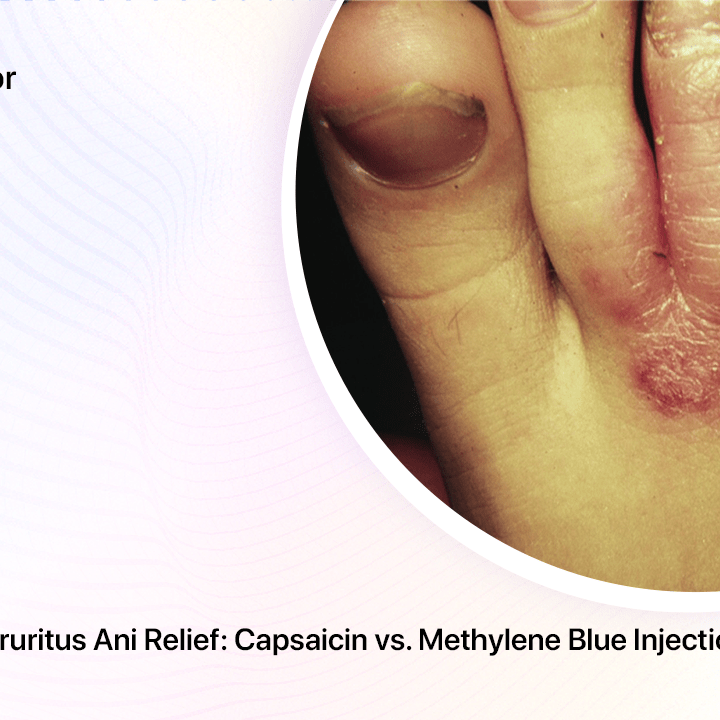 Understanding Pruritus Ani Relief Capsaicin vs. Methylene Blue Injection