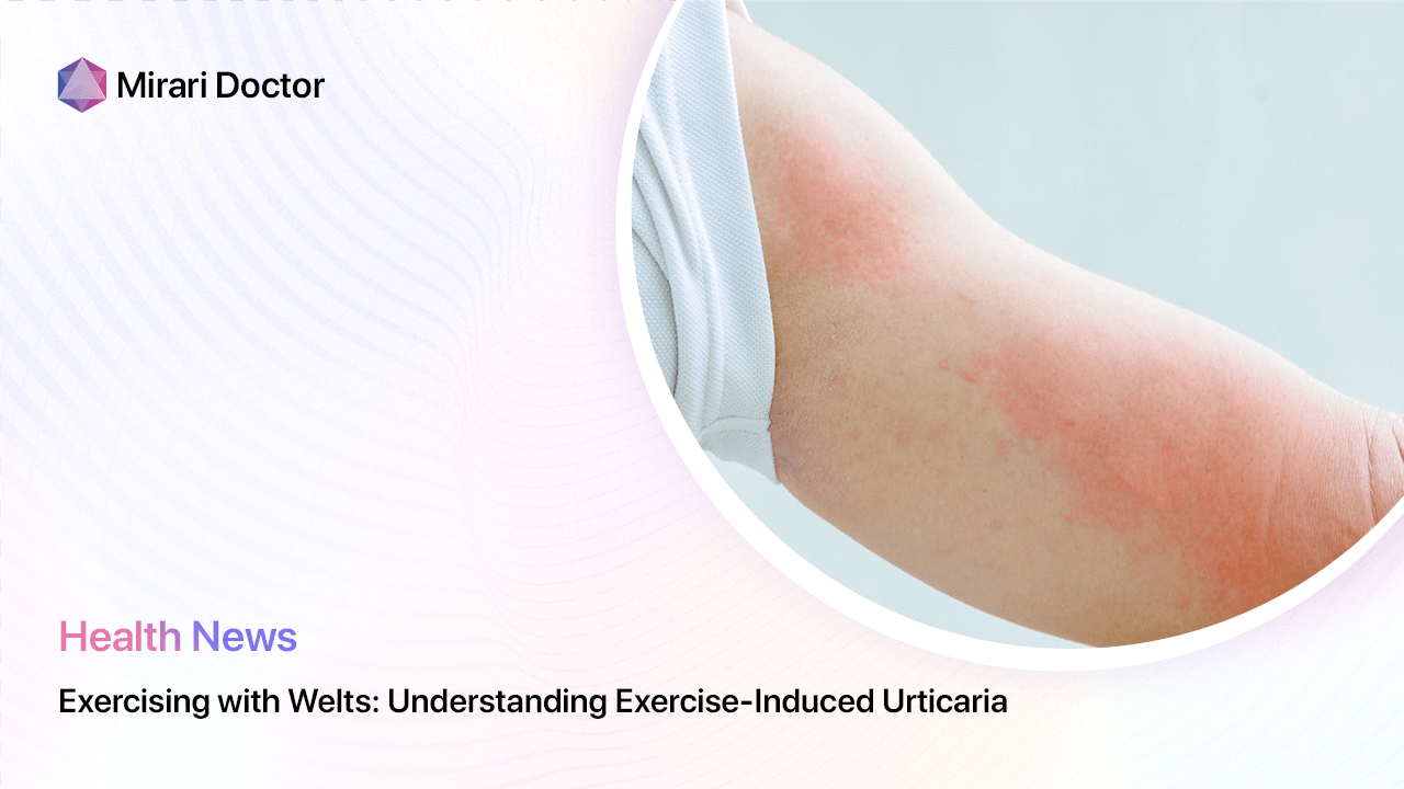 Featured image for “Exercising with Welts: Understanding Exercise-Induced Urticaria”