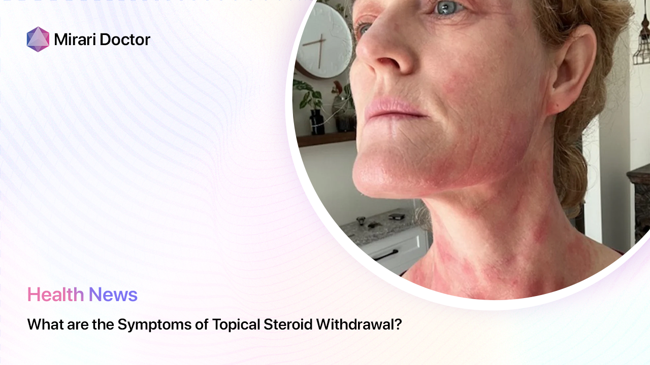 Featured image for “What are the Symptoms of Topical Steroid Withdrawal?”