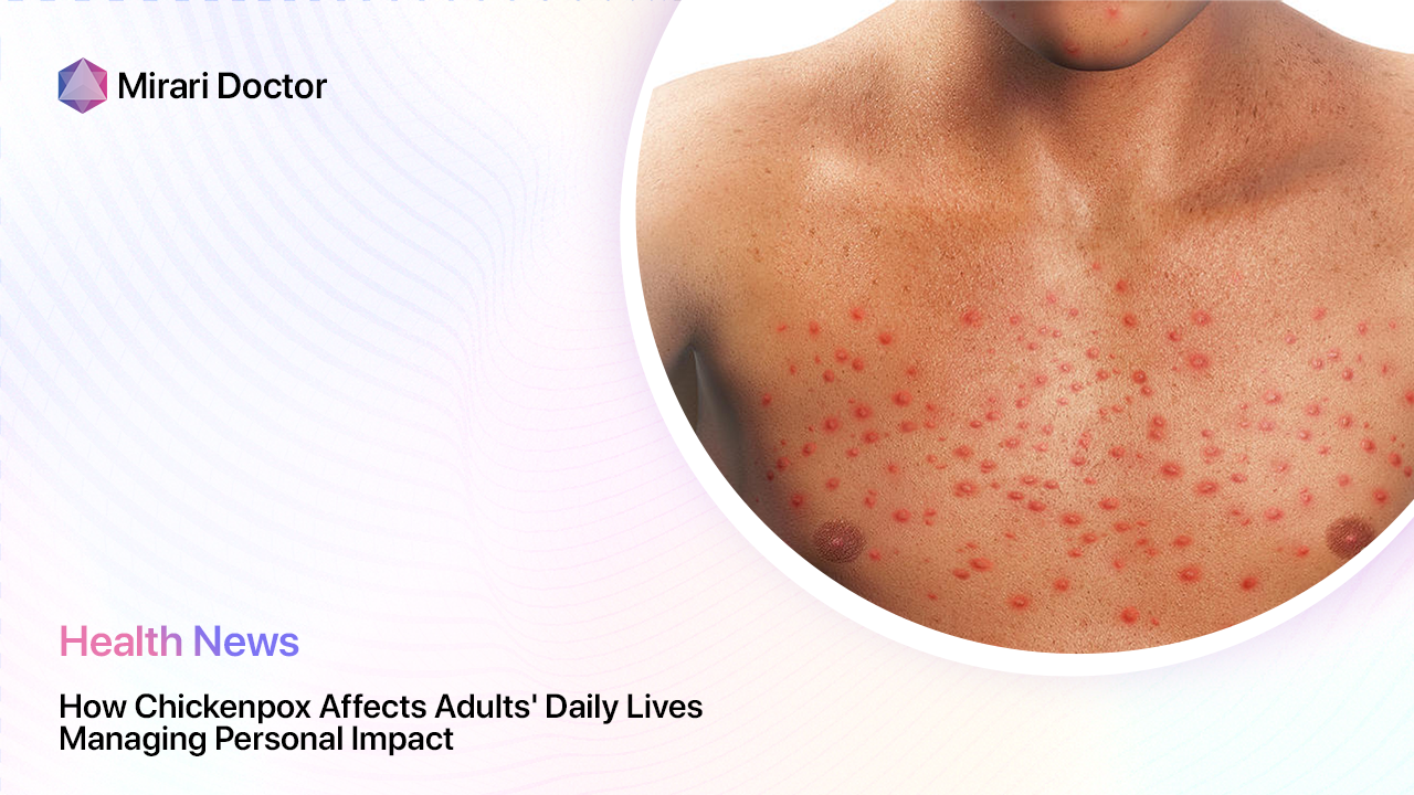 Featured image for “How Chickenpox Affects Adults’ Daily Lives: Managing Personal Impact”