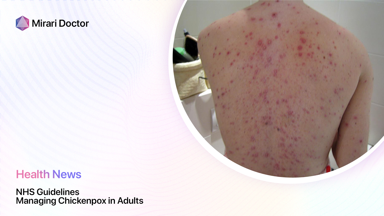 Featured image for “NHS Guidelines: Managing Chickenpox in Adults”