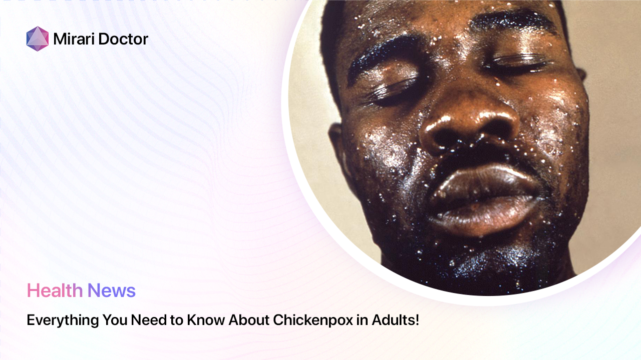 Featured image for “Everything You Need to Know About Chickenpox in Adults!”