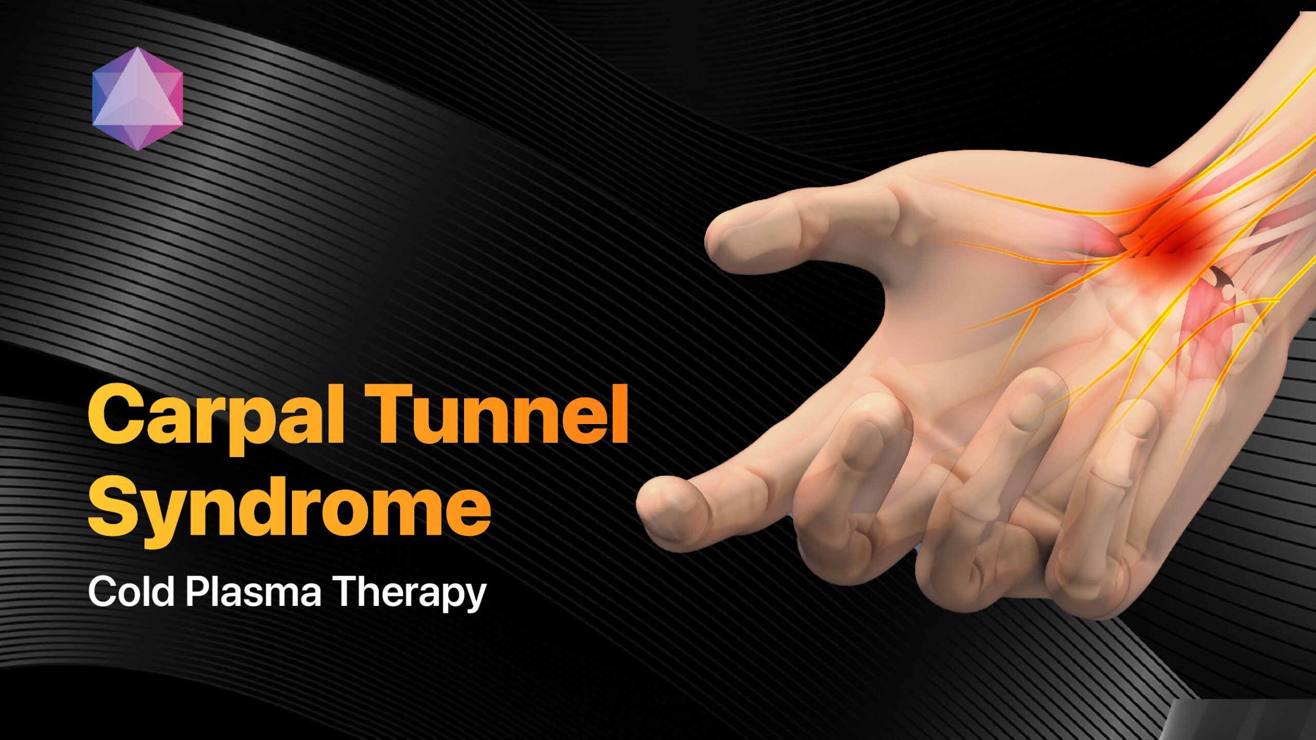 Featured image for “Carpal Tunnel Syndrome Relief: The Power of Cold Plasma Therapy”