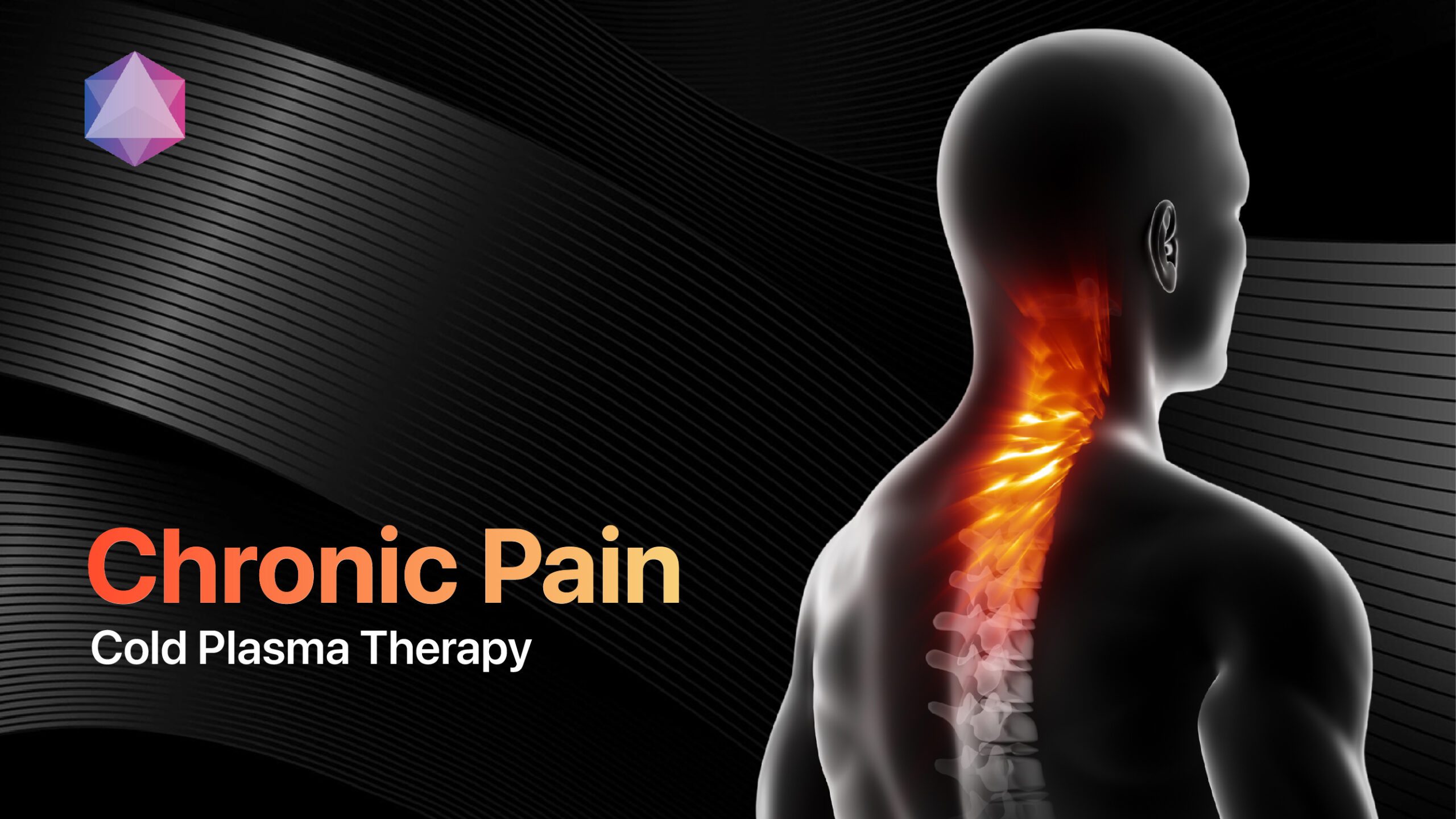 Featured image for “Chronic Pain: Comprehensive Understanding and Cold Plasma Technology Solutions”