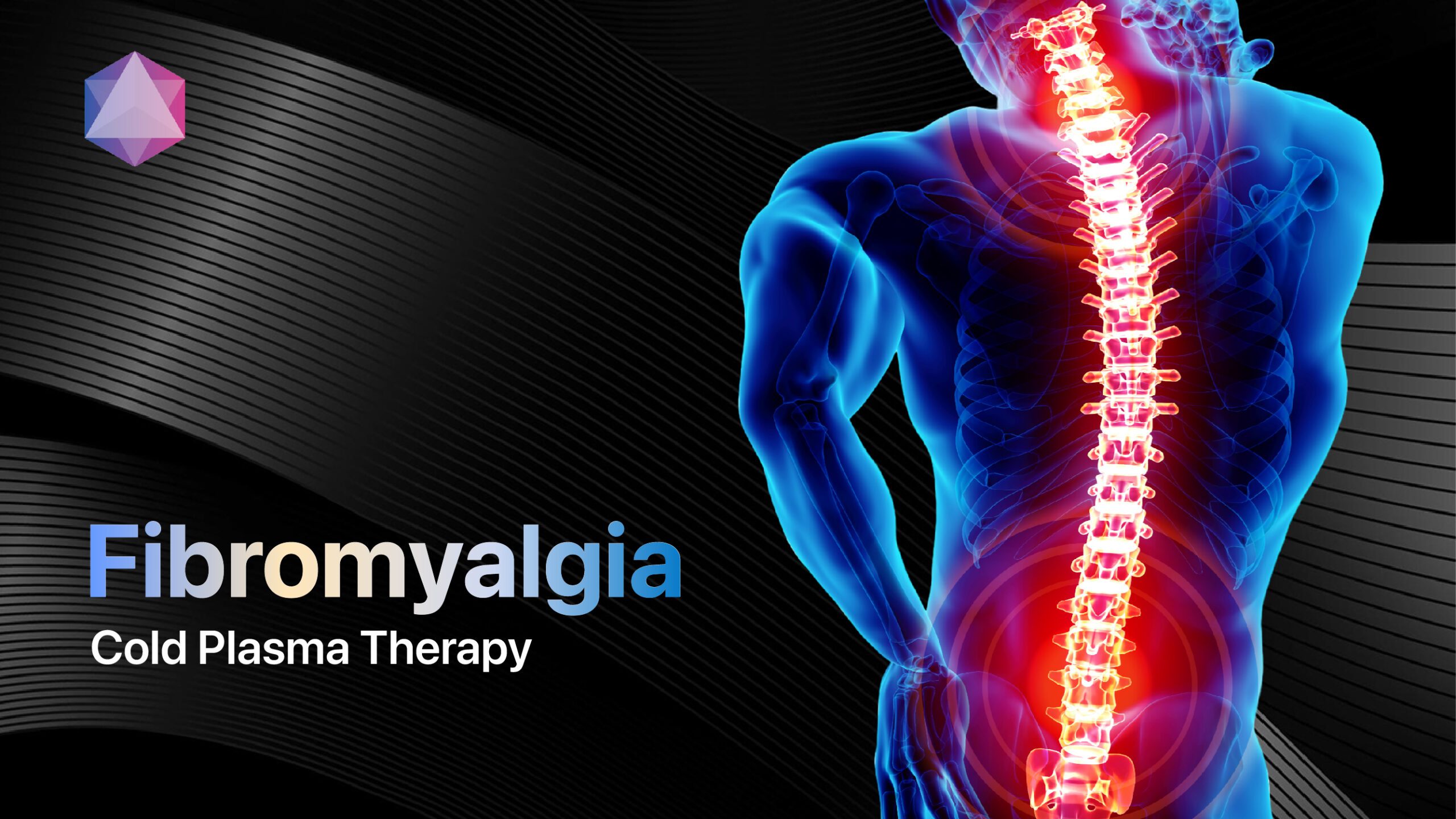 Featured image for “Fibromyalgia Relief: The Power of Cold Plasma Therapy”