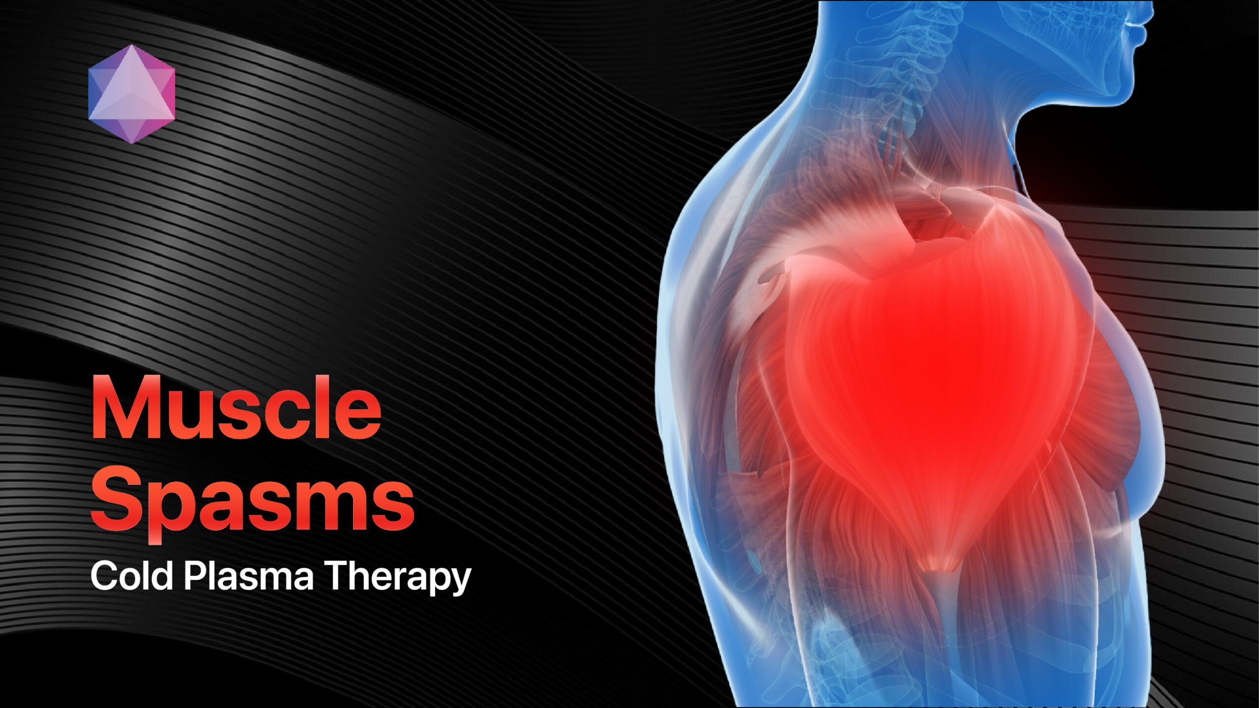 Featured image for “Muscle Spasm Relief: The Power of Cold Plasma Therapy”