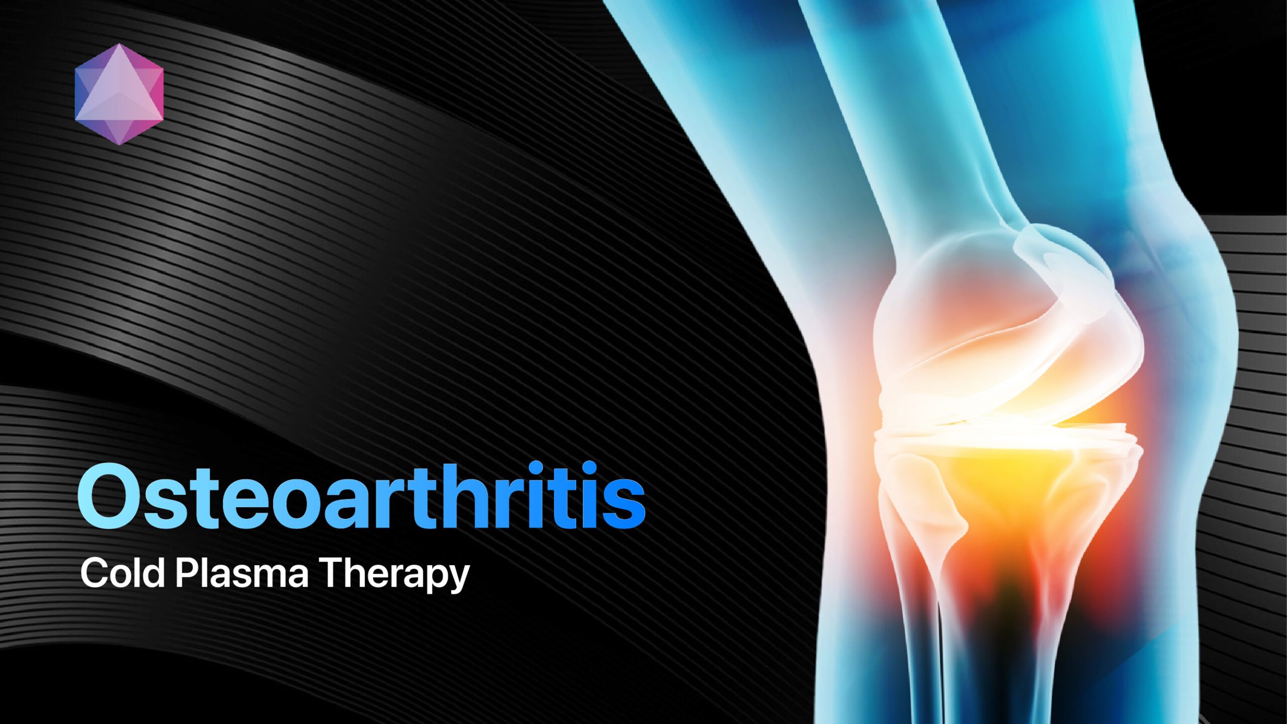 Featured image for “Osteoarthritis Relief: The Power of Cold Plasma Therapy”