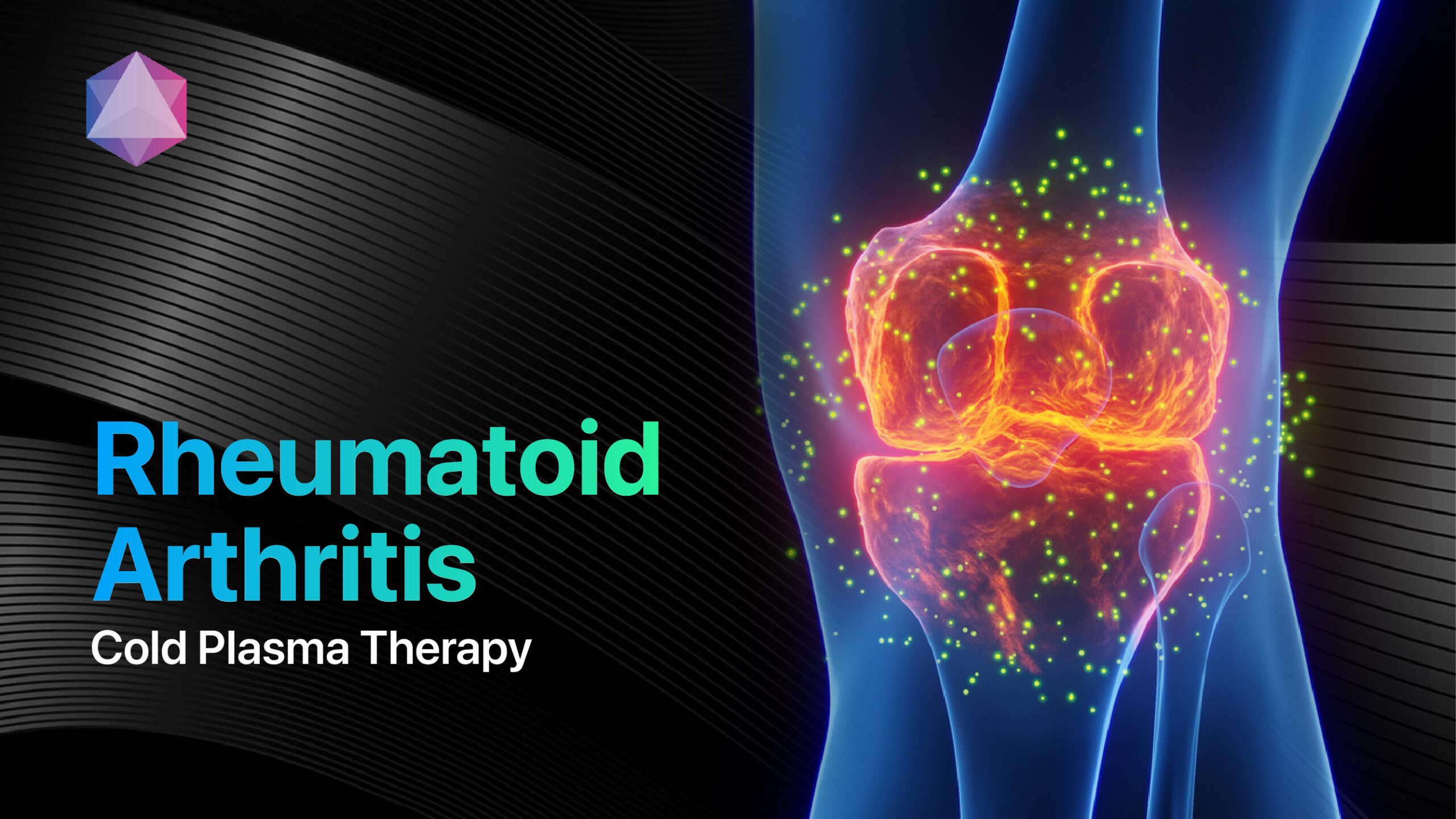 Featured image for “Rheumatoid Arthritis Relief: The Power of Cold Plasma Therapy”