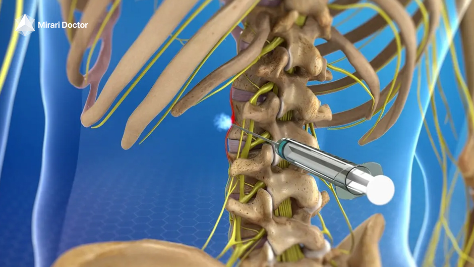 Sympathetic nerve blocks