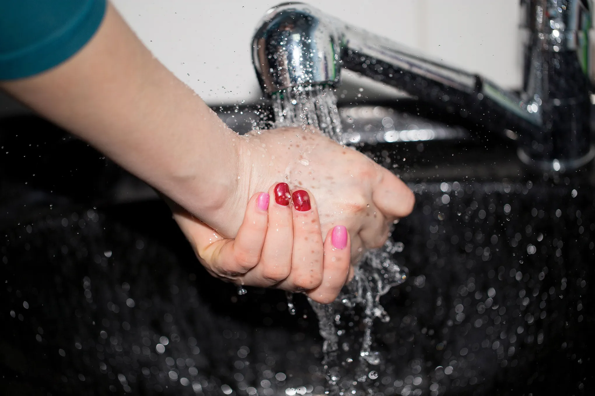Featured image for “What Happens If You Don’t Treat A Burn: Serious Risks”