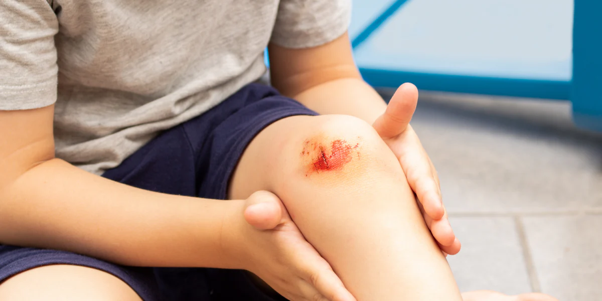 Featured image for “What to Do When Wound is Not Healing?Complete Action Guide”