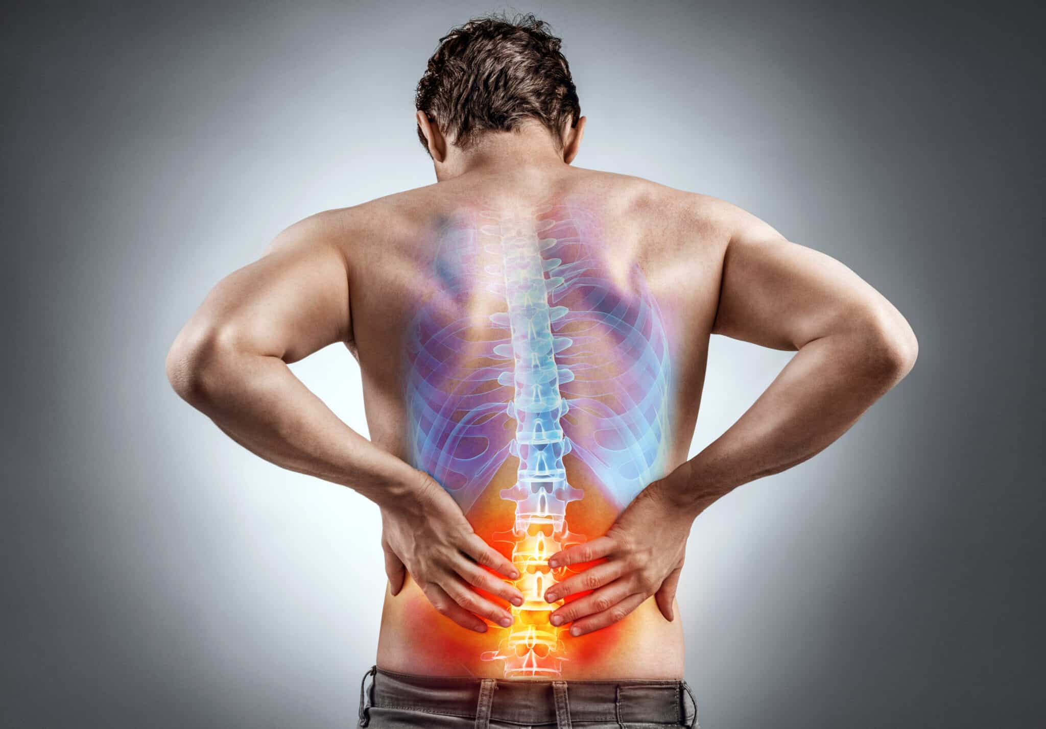 Featured image for “Bone Spurs (Spondylosis): Complete Treatment Guide with Cold Plasma Therapy”